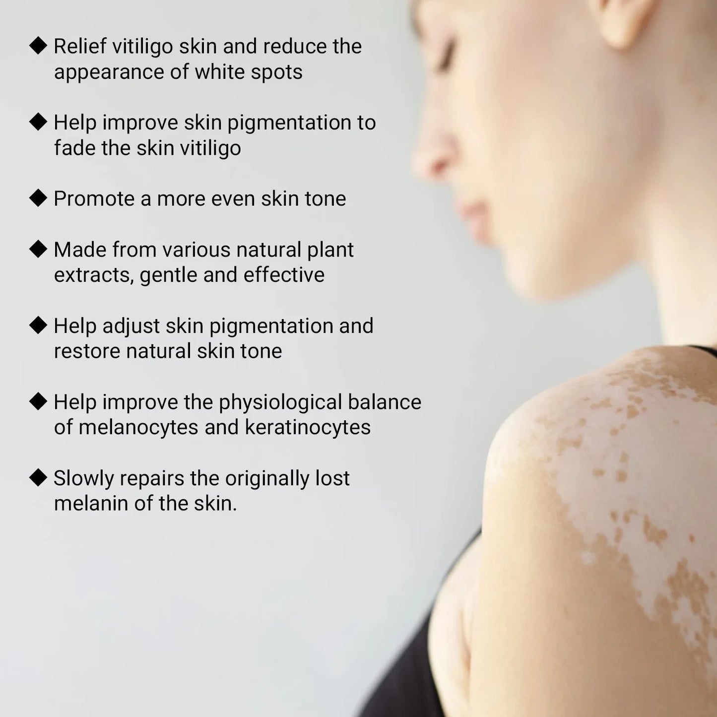 Vitiligo Removal Spray Moisturizer