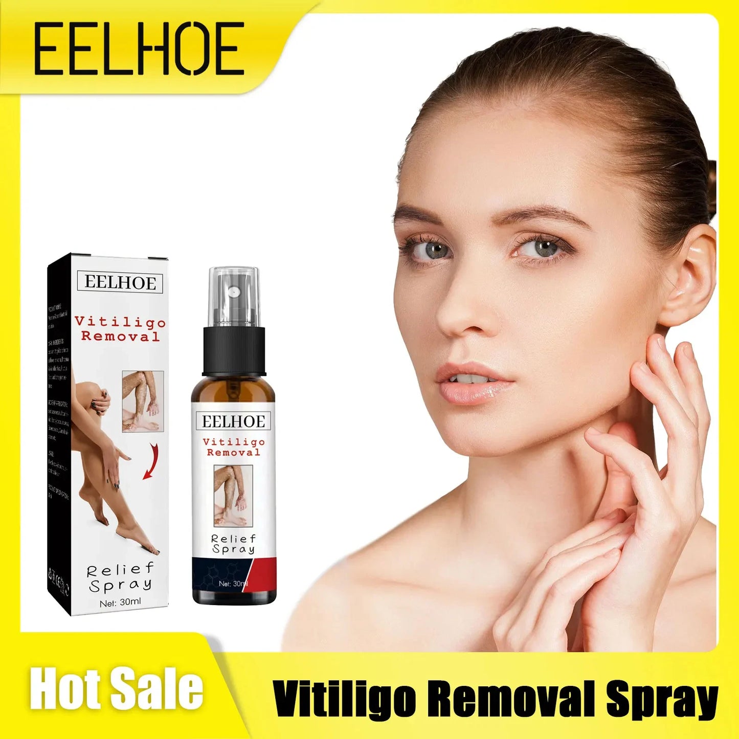 Vitiligo Removal Spray Moisturizer